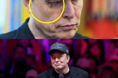 Elon Musk’s Loyalty Up for Grabs? Tech Titan Reveals Shocking Black Eye Story—And It’s Not What You Think